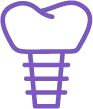 implant restorations